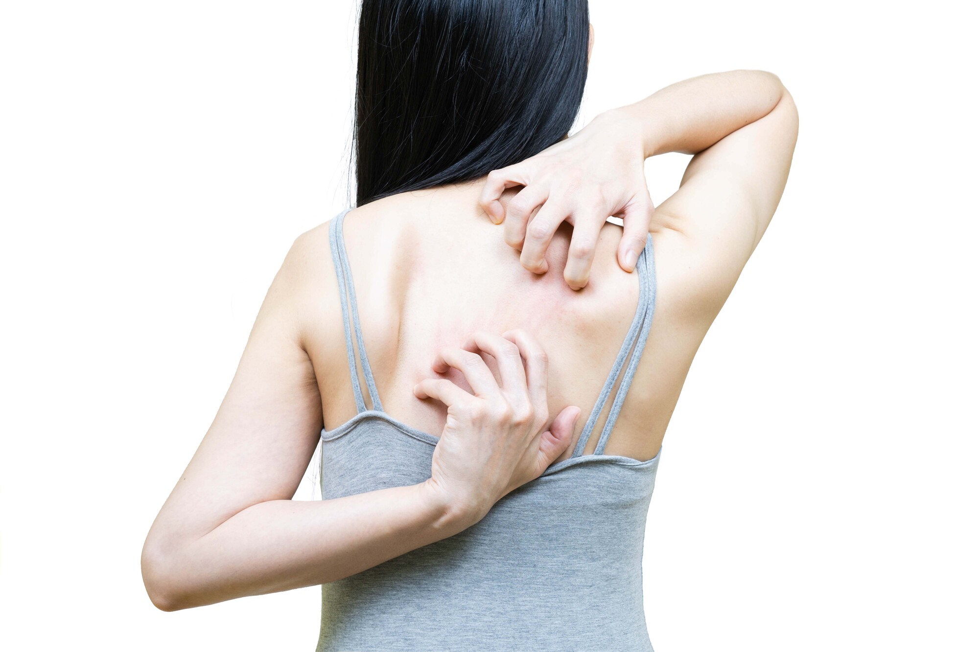 背中が痛い女性